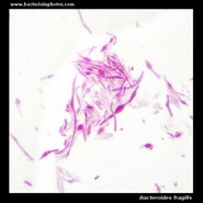 bacteroides fragilis under microscope
